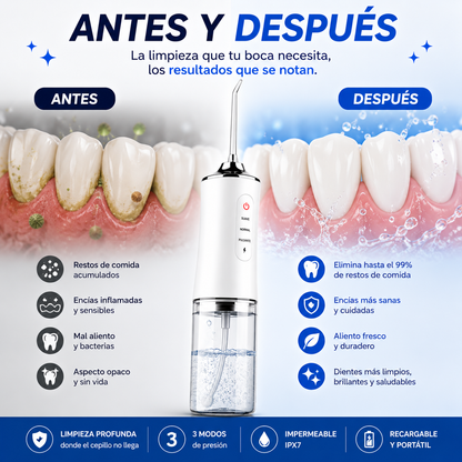 HydroJet™ | Irrigador Dental Recargable de Limpieza Profunda
