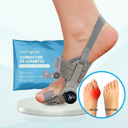 Treatmedy™ | Solución para Juanetes